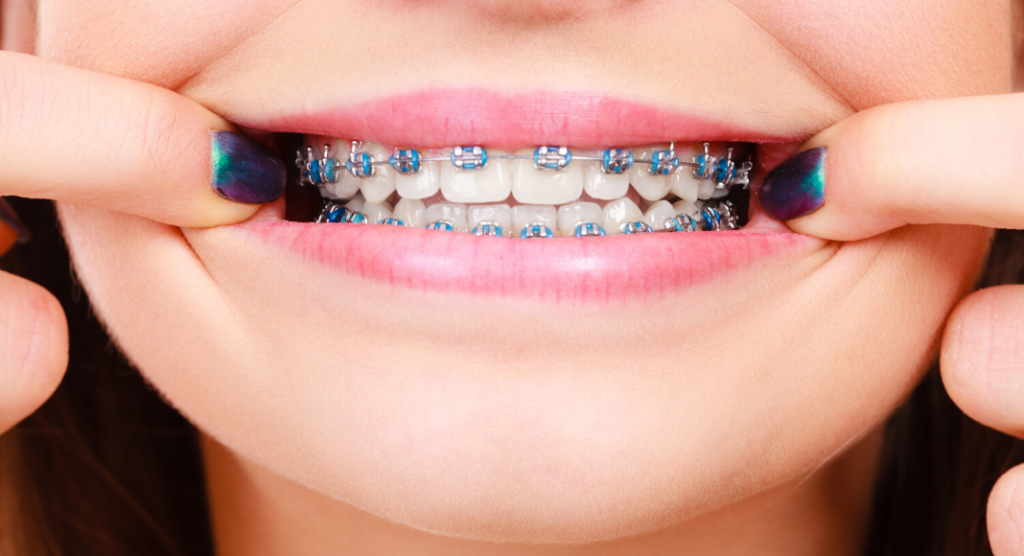 Orthodontic treatment: Northeast Orthodontic Specialists